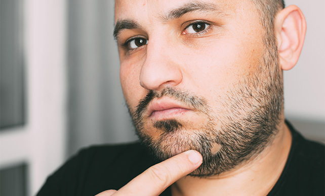 Beard Transplant 02 1