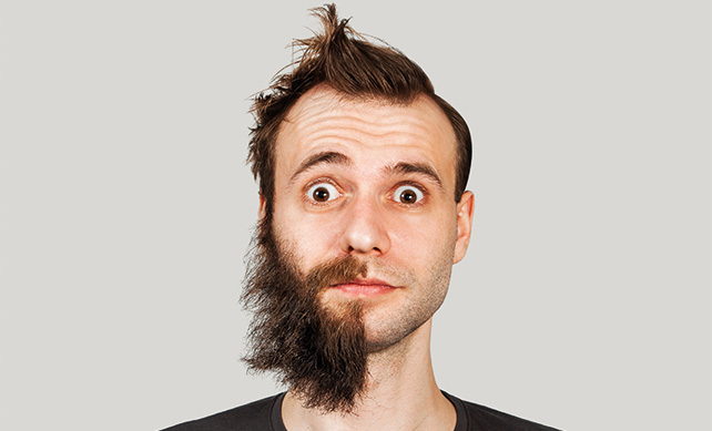 Beard Transplant 04