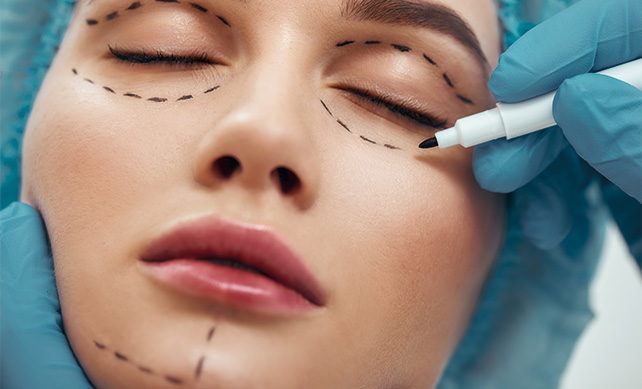 Blepharoplasty Eyelid Lift 02