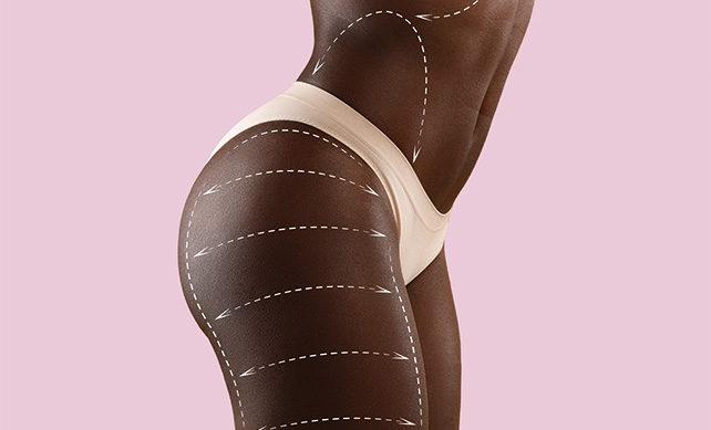 Body Contouring Sculpting 01