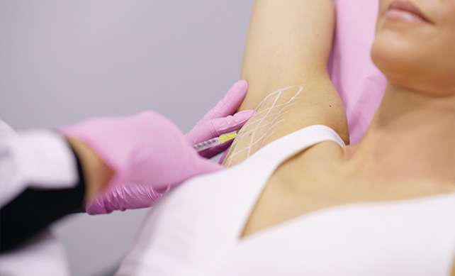 Botox in armpits 01