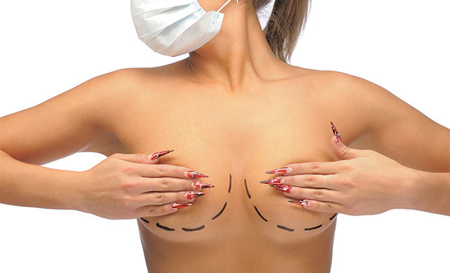 Breast Reduction 04 1