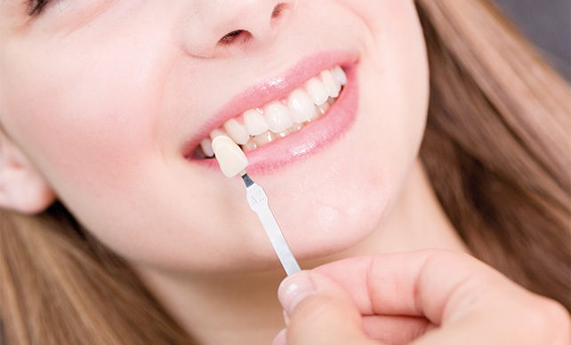 Dental Crowns 4