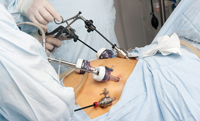 Gastric Bypass 03 1
