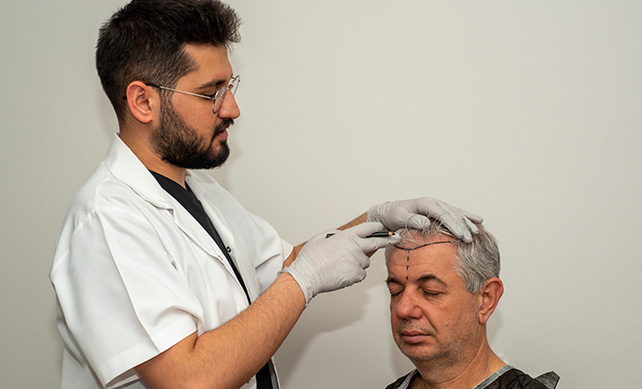 Hair Transplant Turkey 02
