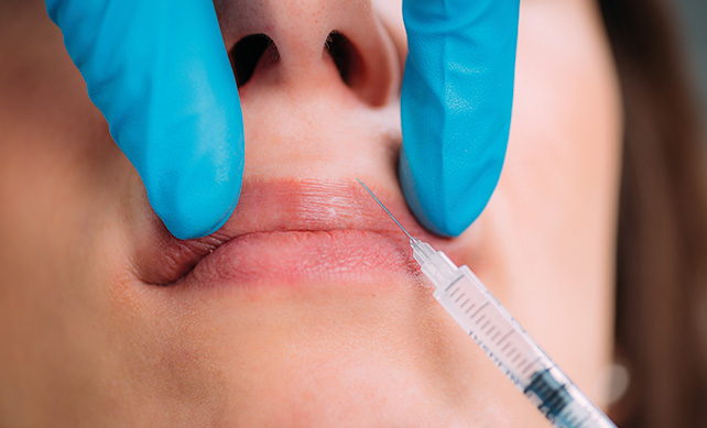 Lip Fillers 03