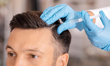 Mesotherapy For Hair 07
