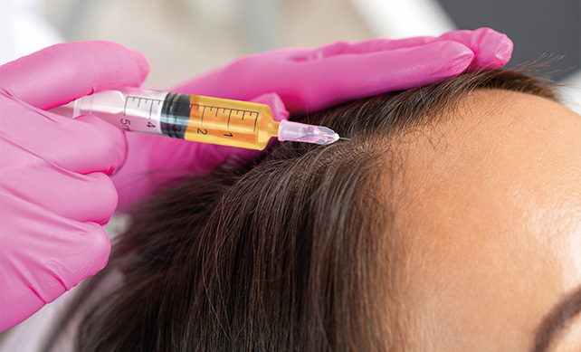 PRP For HairTreatment 01