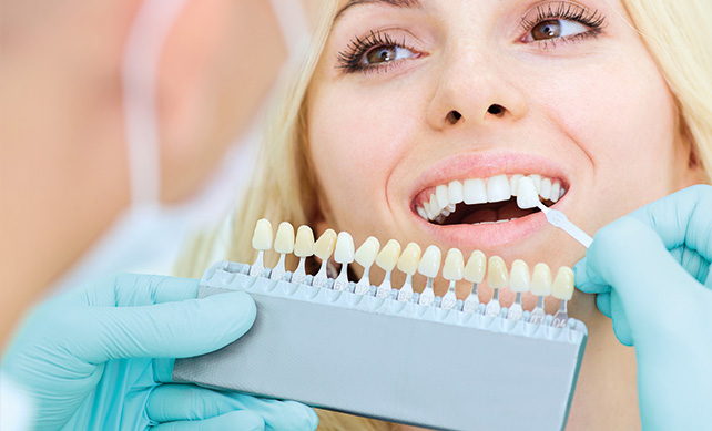 Porcelain Crowns 01