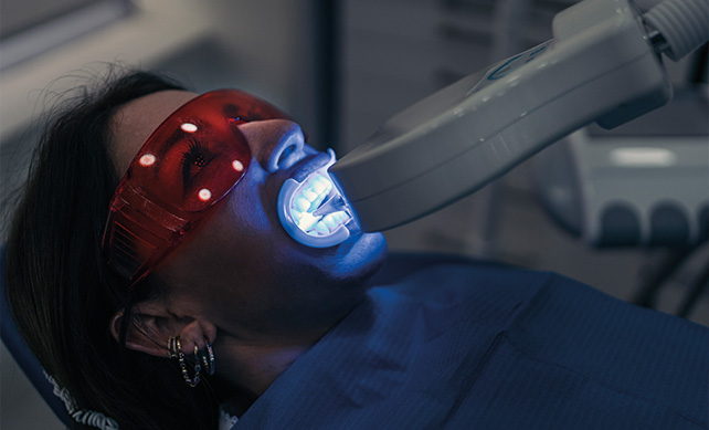 Teeth Whitening 02