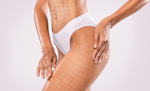 Thigh Lift 02