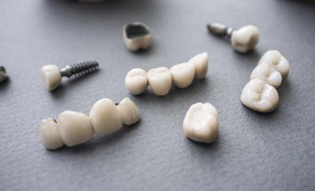Tooth Implant 03