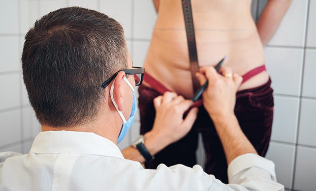 Tummy Tuck 04 1