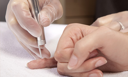 Wart Treatment 05