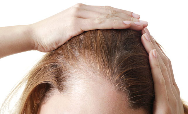 Women Hair Transplant 02 1