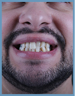 man 2