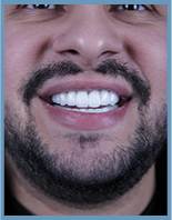 man 3