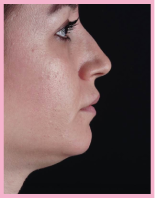 woman 2