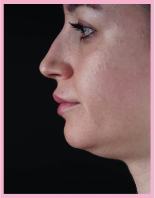 woman 3