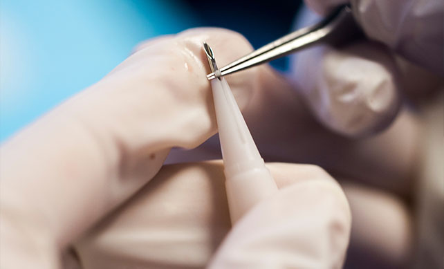 DHI Hair Transplant 30