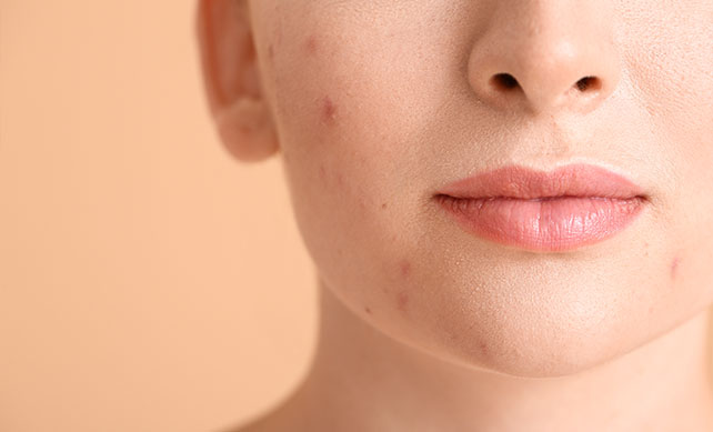 Spot Treatment