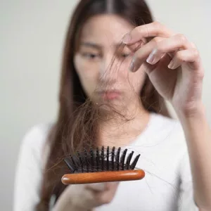 Hairloss 01