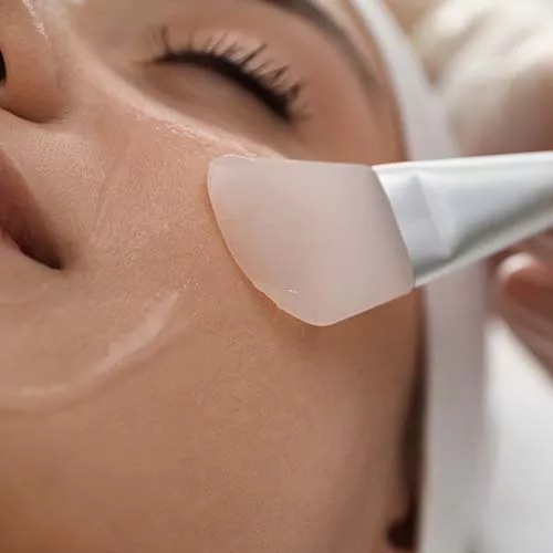 Kimyasal Peeling 03 jpg