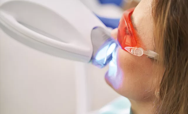 Teeth Whitening 01