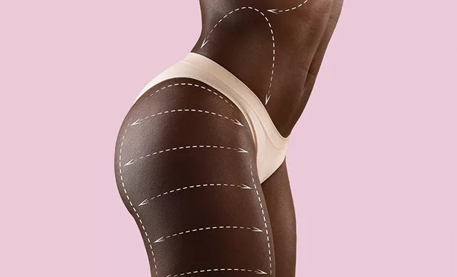 Body Contouring (Sculpting) 01
