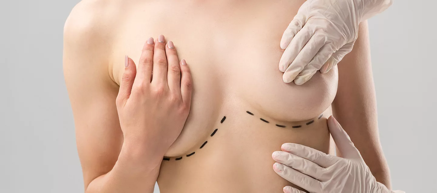 Breast Lift