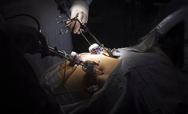 Gastric Bypass 02 germany