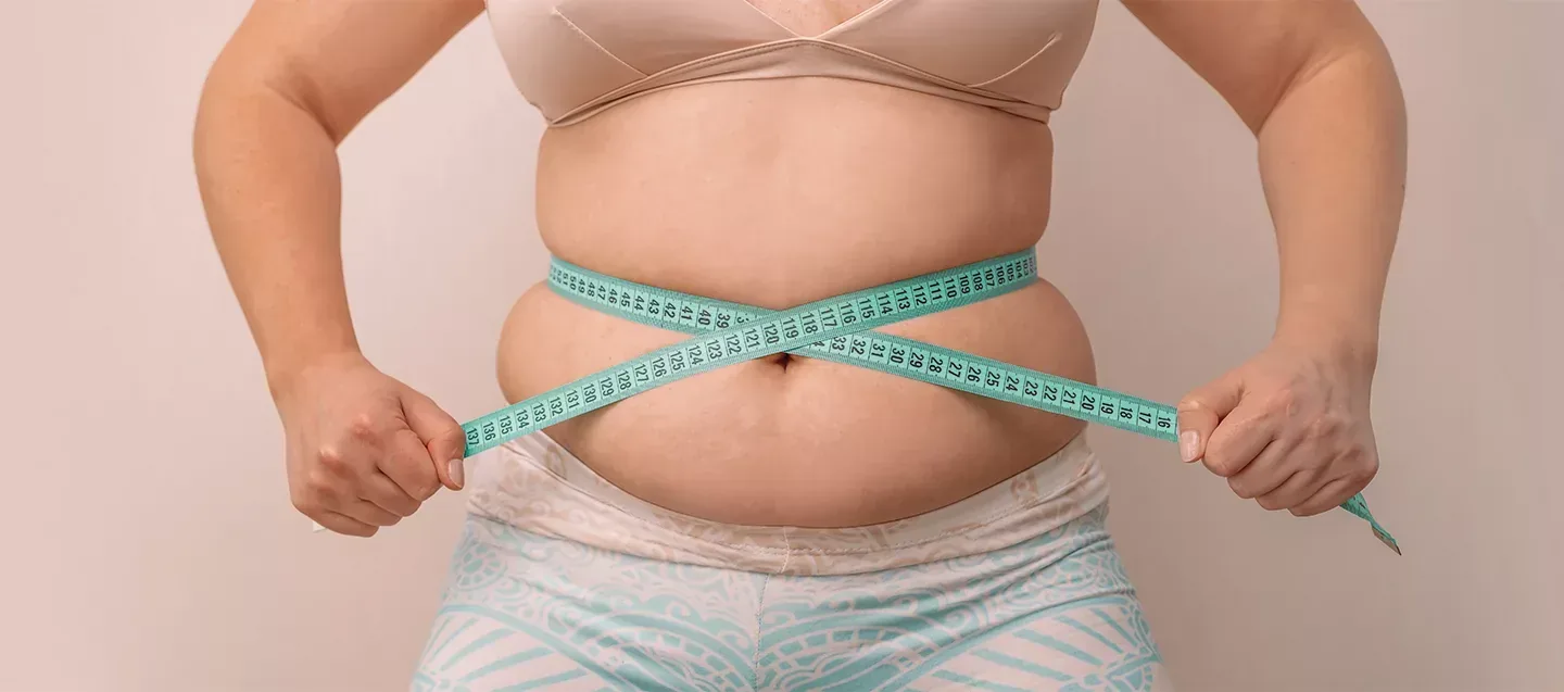 Gastric Sleeve