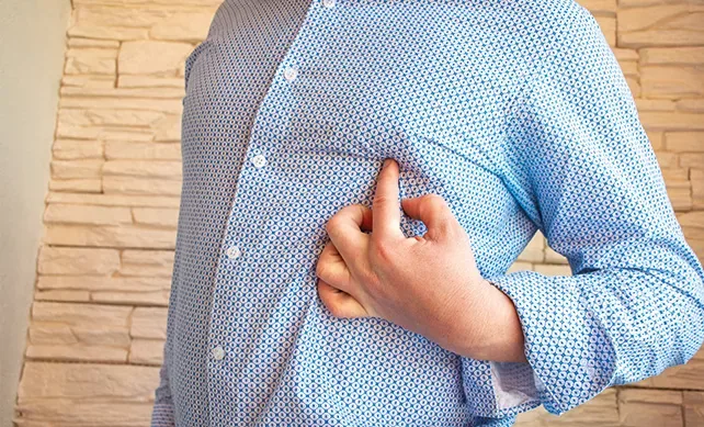Gynecomastia 01