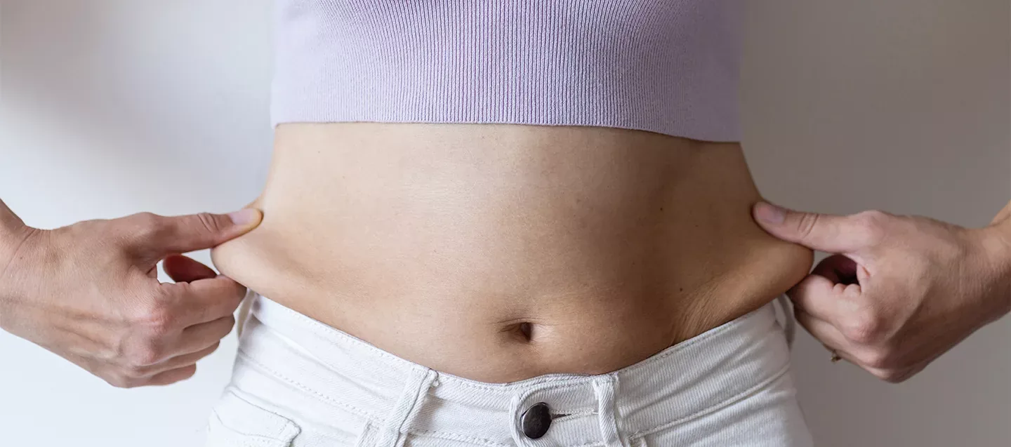 Tummy Tuck