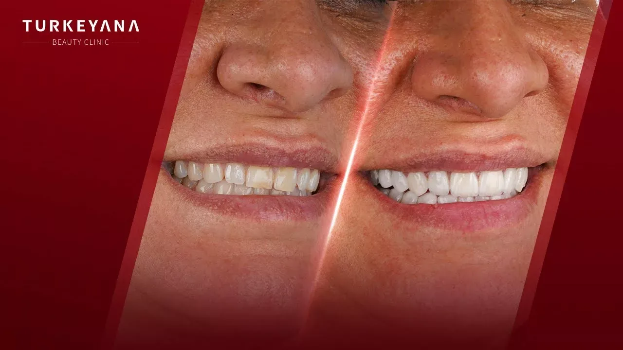 dental 4 jpg
