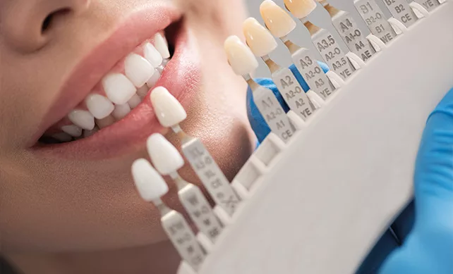 Dental Crowns 2