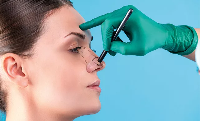 Rhinoplasty 02