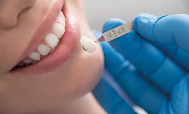 Dental Crowns 1
