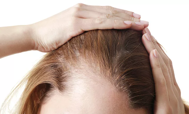Women Hair Transplant 02