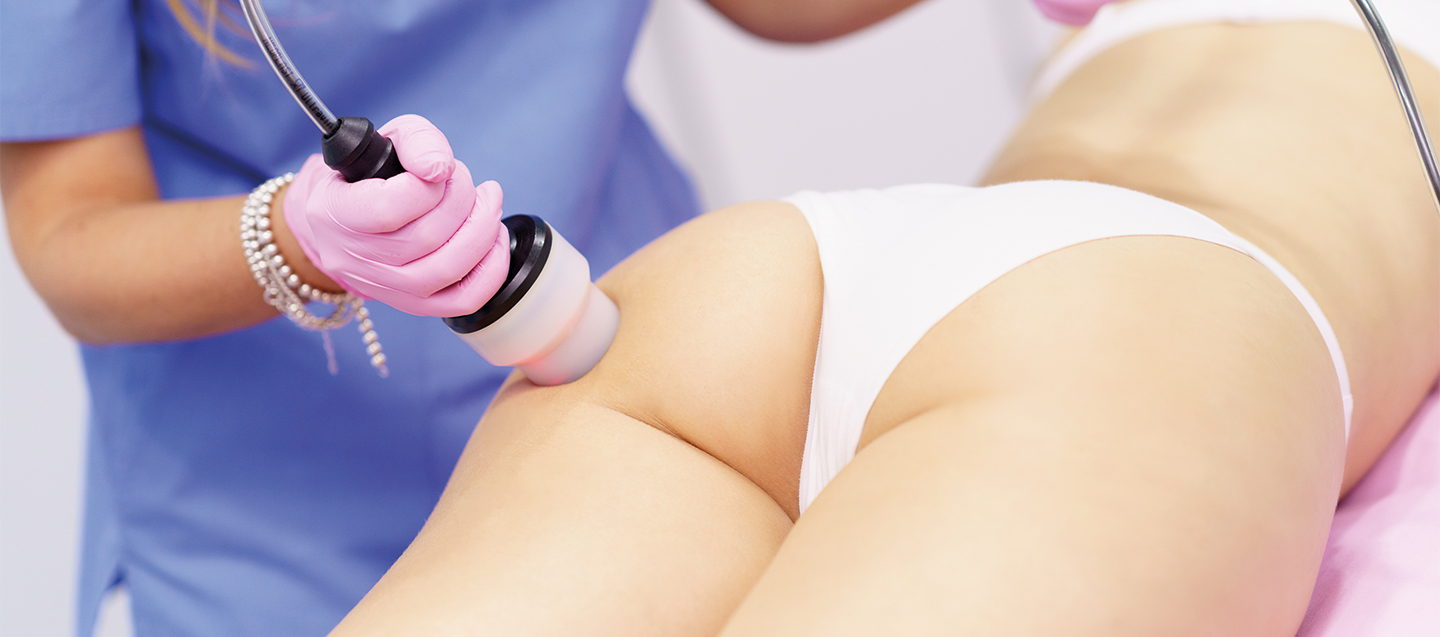Achieve the Perfect Curves: A Comprehensive Guide to Brazilian Butt Lift (BBL) Surgery