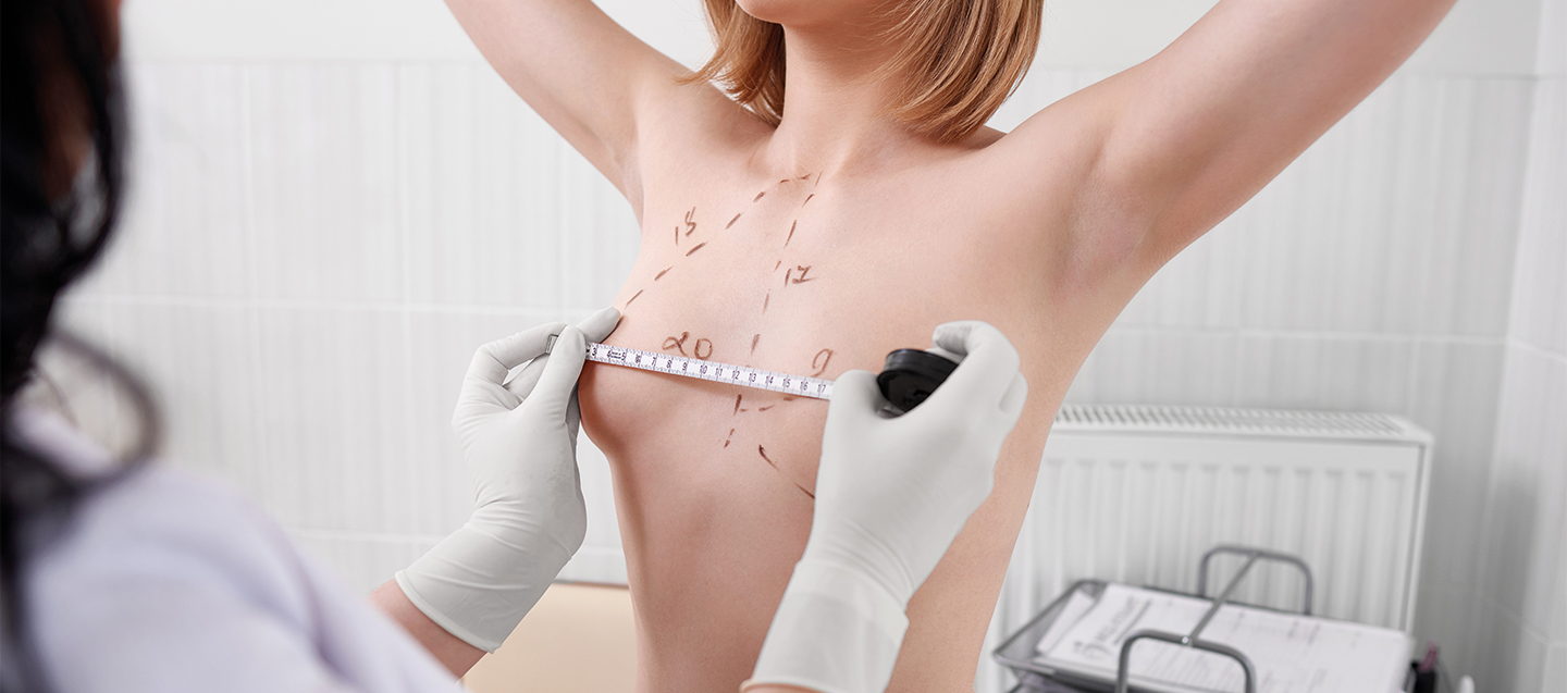 Breast Augmentation: A Comprehensive Guide