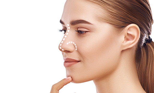 Rhinoplasty 01