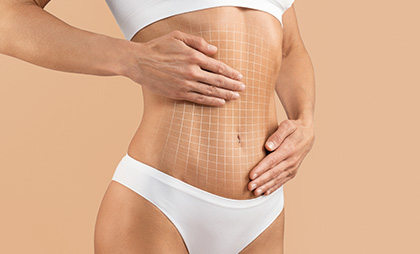 Tummy Tuck 06