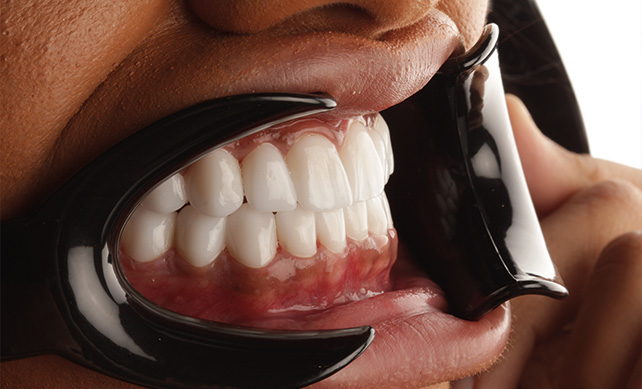 Zirconium Crown 03