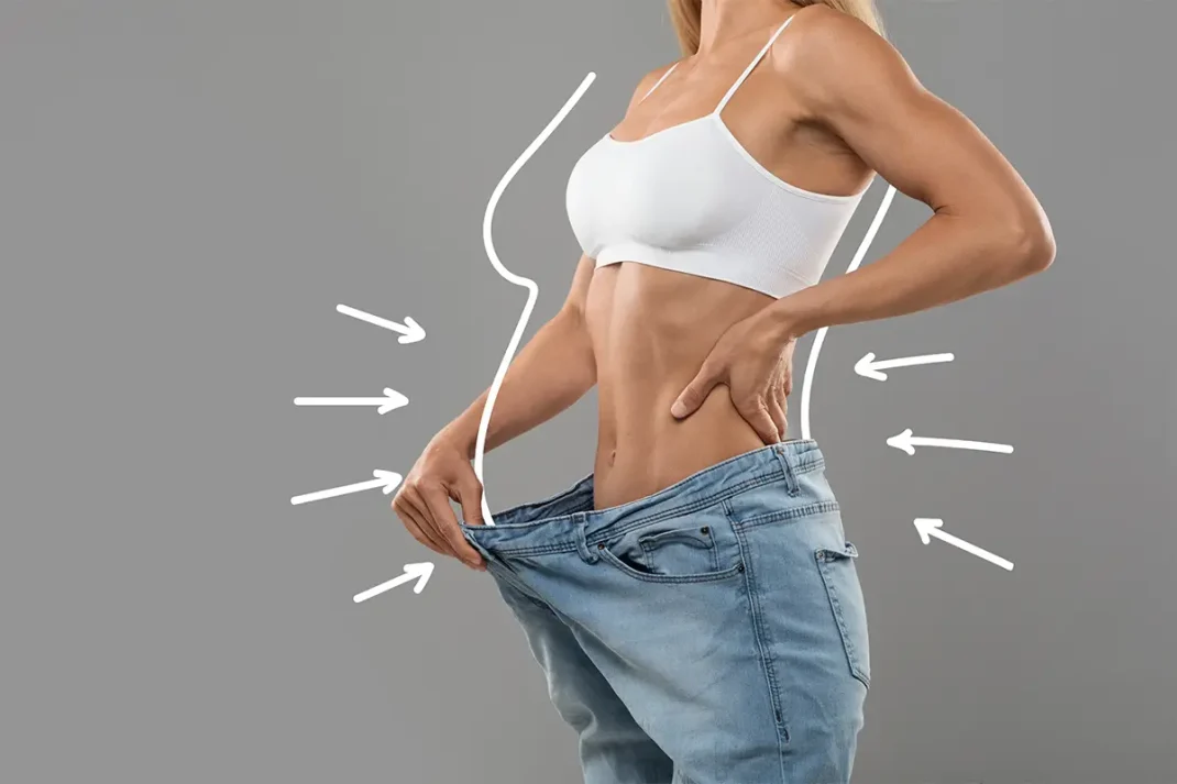 liposuction vs weight loss any difference 1070x713