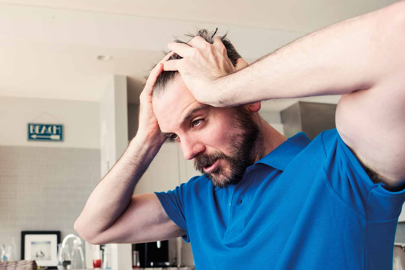 Side Effects of Hair Transplant